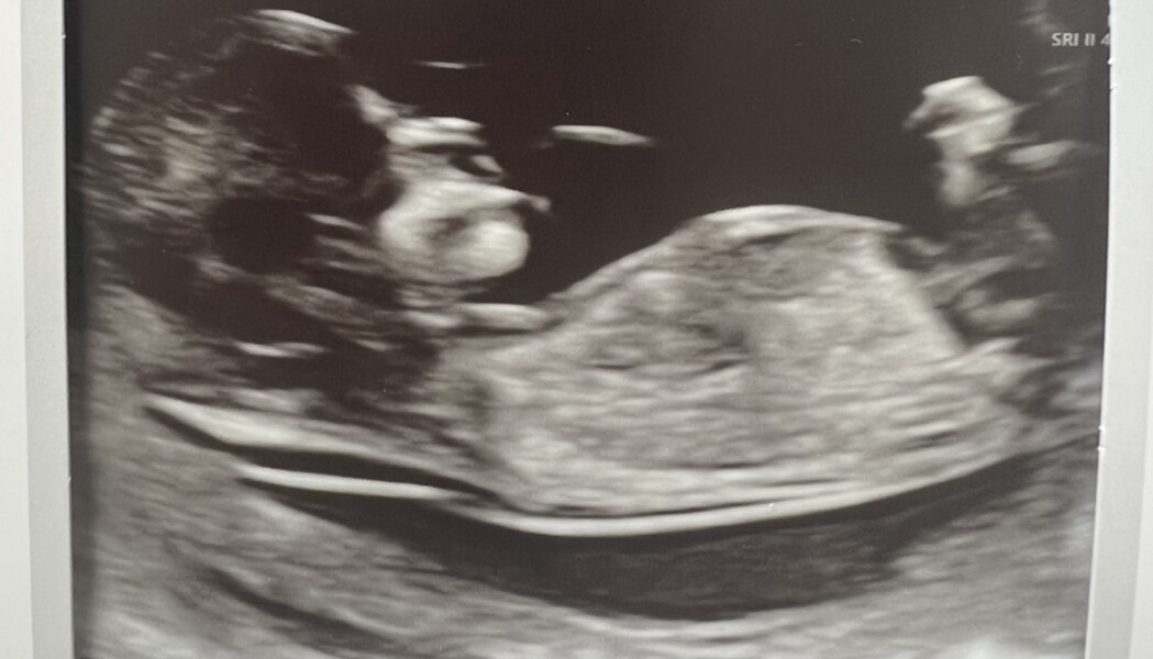 12 weeks - guesses please!
