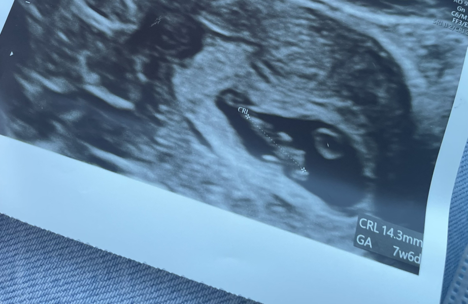 Babies Due April 2023 Thread 4 