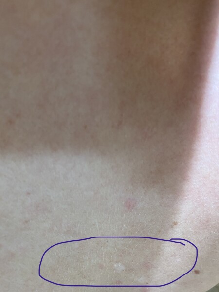 Anyone know what’s going on with my skin?