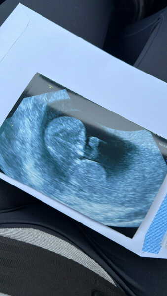 Due March 2023 - thread 2 