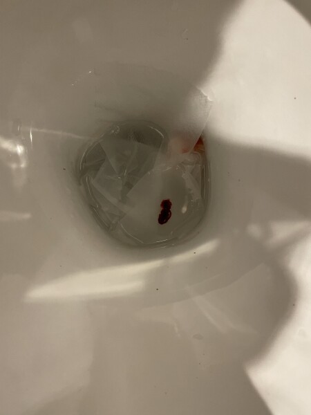 7 weeks and bleeding - help! 