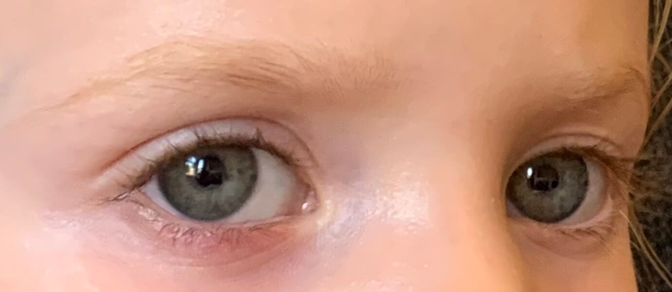 DD’s eye - help please! 