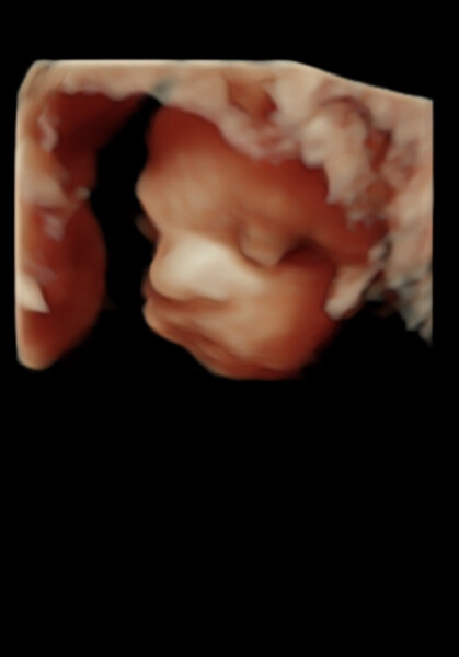Navigating pregnancy after loss thread 4!