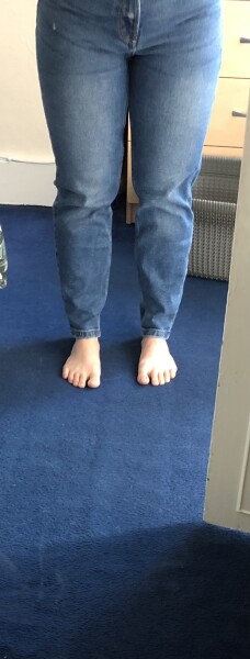 Please tell me what’s wrong with my legs!
