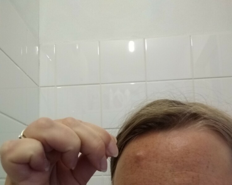Hair growing on forehead
