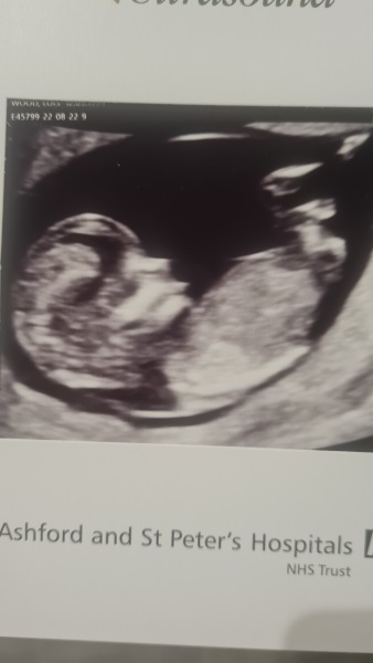Due March 2023 - thread 2 