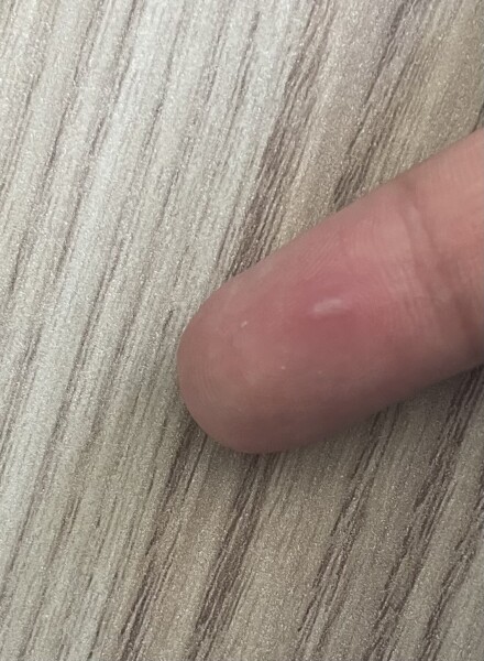 What is this lump? Appeared overnight 