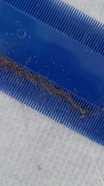 Treating Lice??