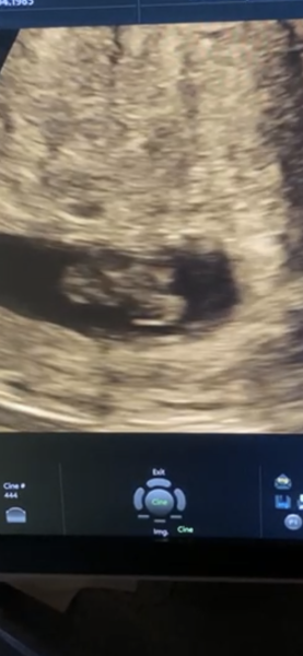 Babies due April 2023 thread 3