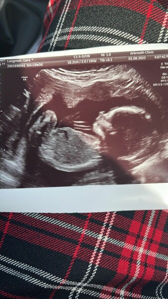 Due December 2022 (thread 4)
