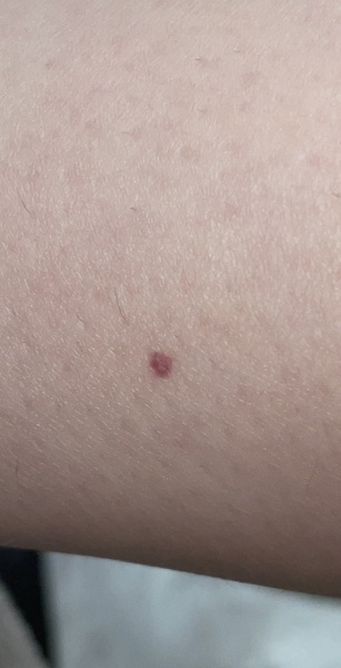 Red mark - blood spot or other?