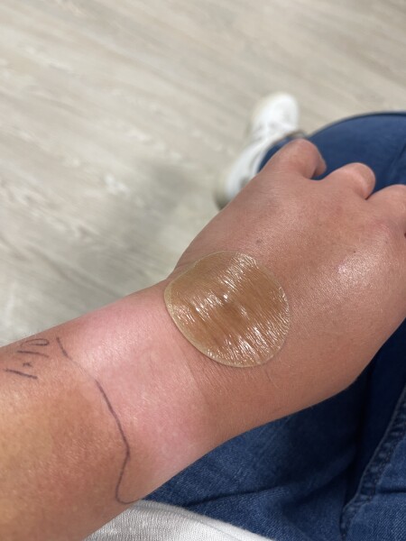 Infected bite, when to get further help? 