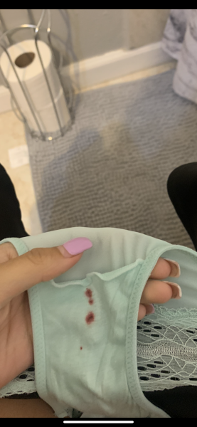 Spotting/bleeding 