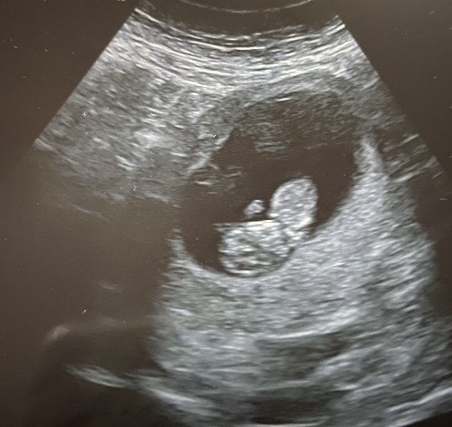 Due March 2023 - thread 2 
