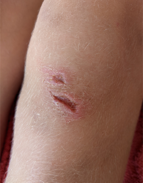 Help! DS has shredded his knee (photo)