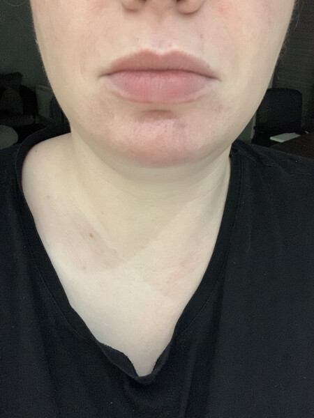 Why have my lips gone blue?!