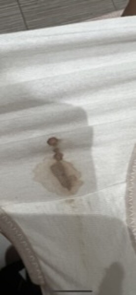 Implantation Bleeding 