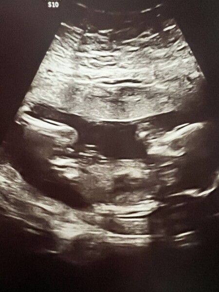 Any sonographers here? 