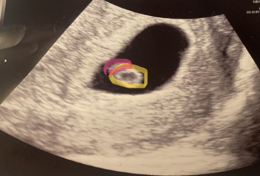 Babies due April 2023