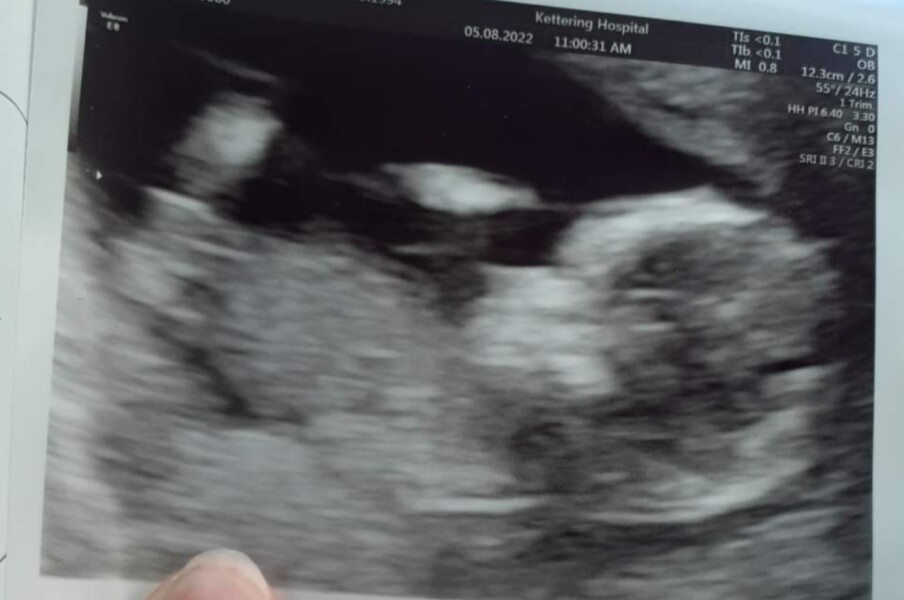 Nub Theory/Boy or Girl?