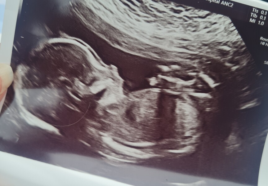 Baby January 2023!