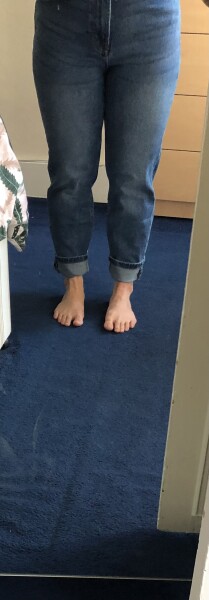 Please tell me what’s wrong with my legs!