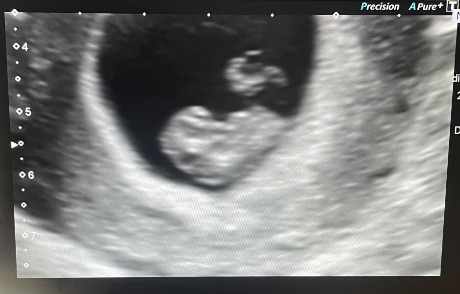 Due Feb/Mar after MC 🌈 🙈