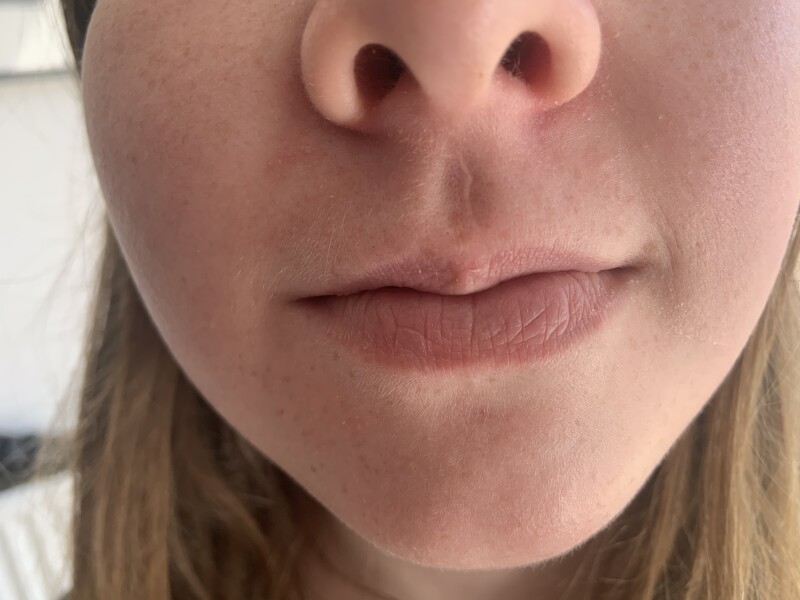 What can I use on DD’s nose?