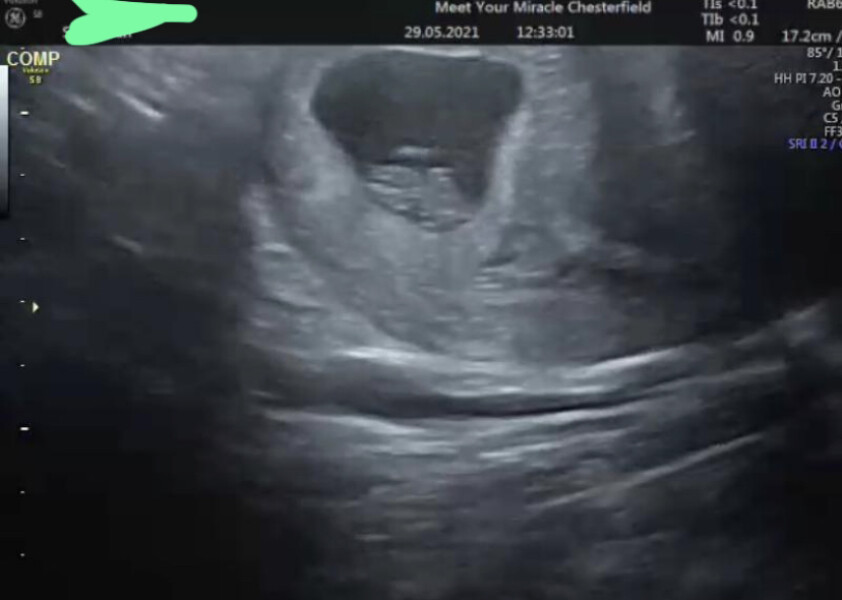 Private scan at 8 weeks?