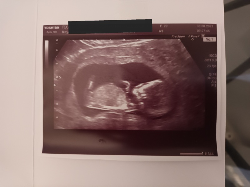 Girl or Boy?