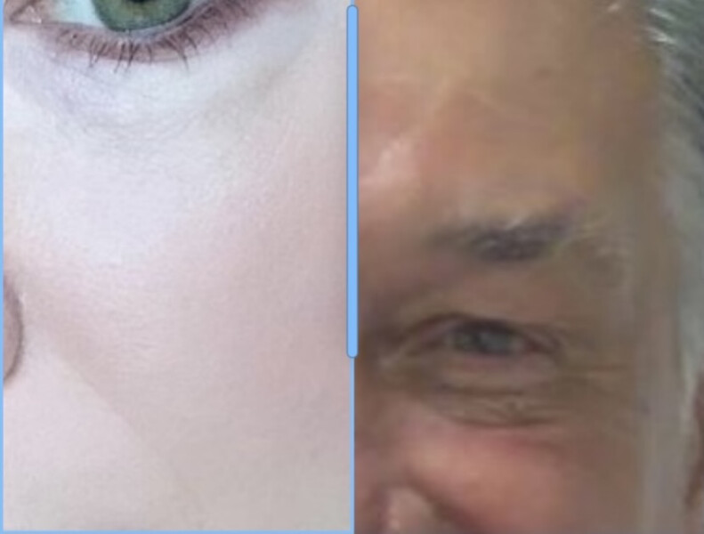 Why are some people so pale?