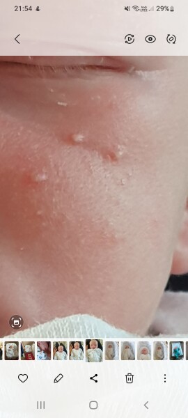 Is this a dribble rash or something else? Help a panicky FTM out!