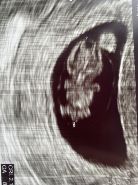 Due March 2023 - thread 2 