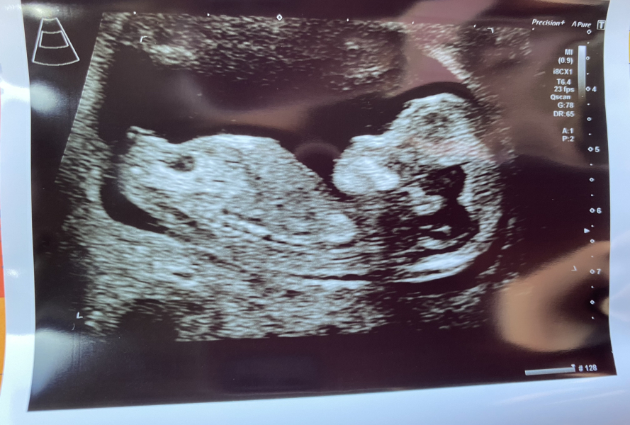 IVFers Due Mar & Apr 2023