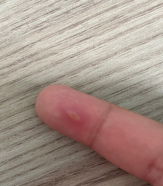 What is this lump? Appeared overnight 