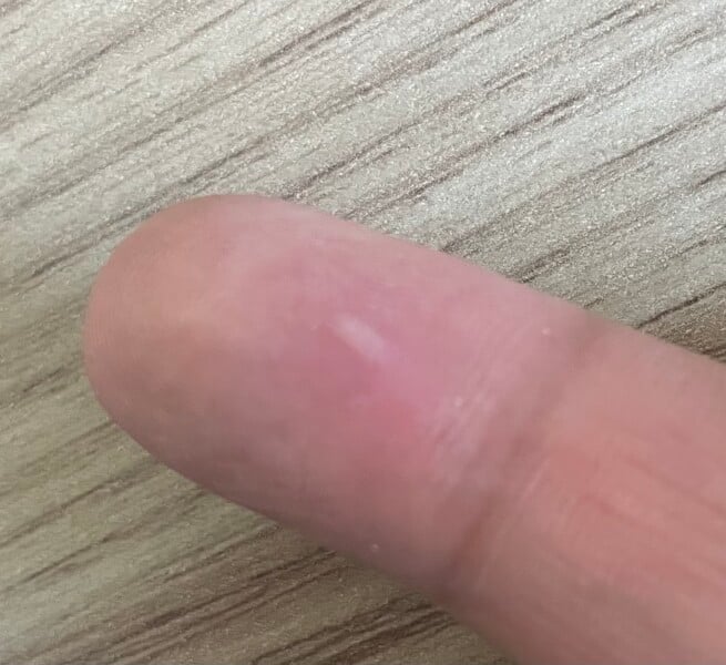 What is this lump? Appeared overnight 