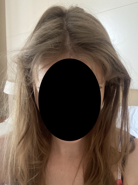 Rubbish hair in pregnancy (pic attached)