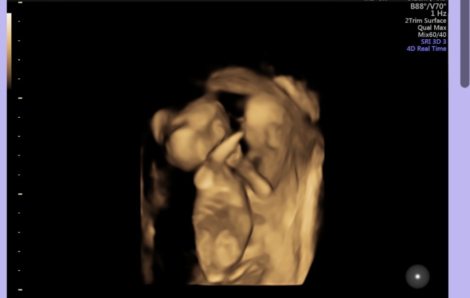 Scans
