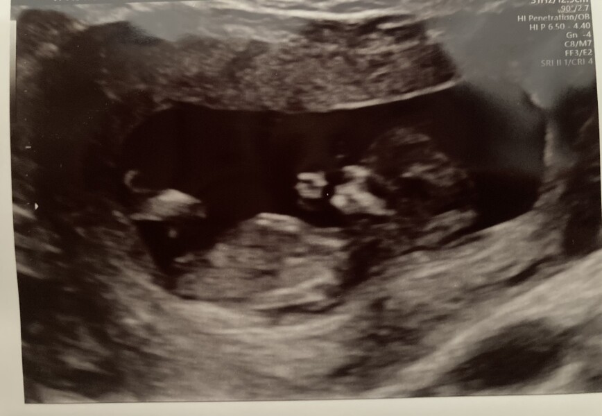 Nub theory predictions?