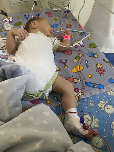 Has anyone experienced HDN (hemolytic disease of the newborn) / rhesus disease?