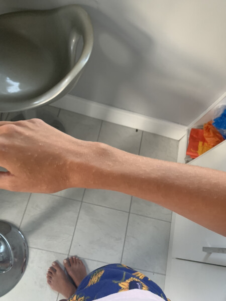 What is this rash? Pic