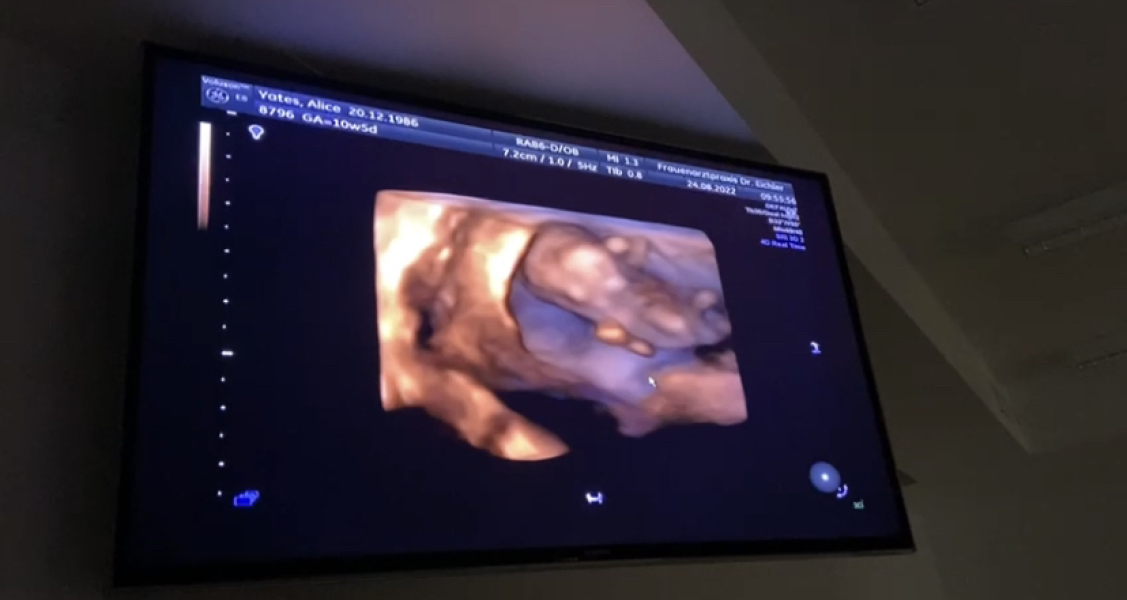 IVFers Due Mar & Apr 2023