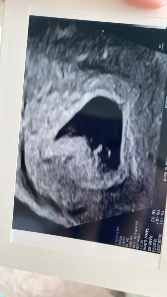 Babies due April 2023