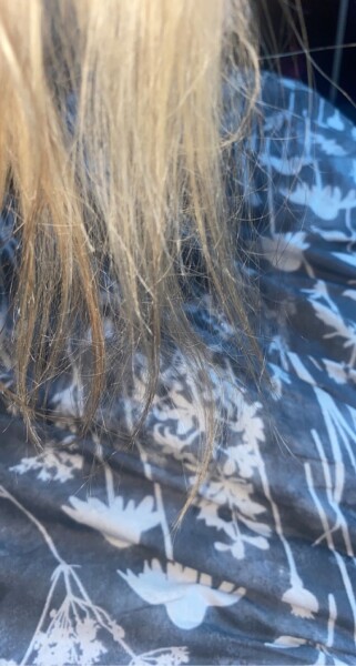 What's wrong with my hair? Breaking off (pics included )