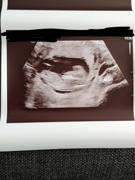 Due March 2023 - thread 2 