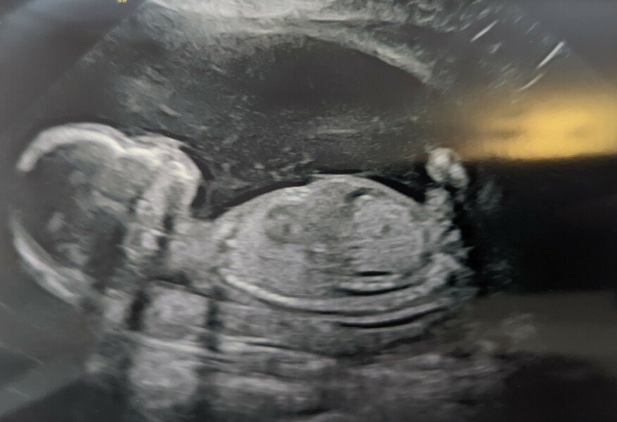 Boy or girl - skull theory?
