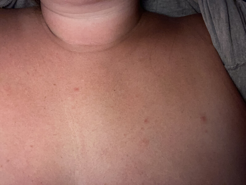 To be worried about this rash?