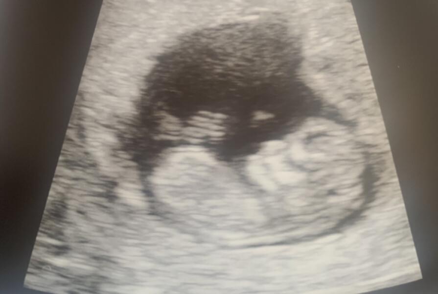 Due March 2023 - thread 2 