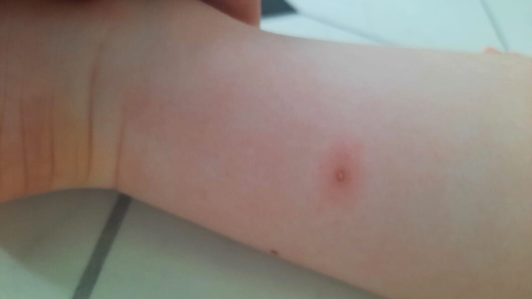 What is this spot?