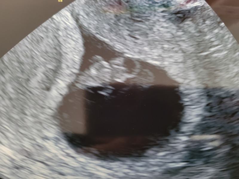 Babies due April 2023 thread 3